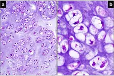 Hiyalin Kıkırdak Özellikleri ve Faydaları Nelerdir?